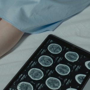 Neuroblastoma, The Treatment is Complicated- Stacy Ettinger, RN, CPNP-AC/PC (0.75 CME)
